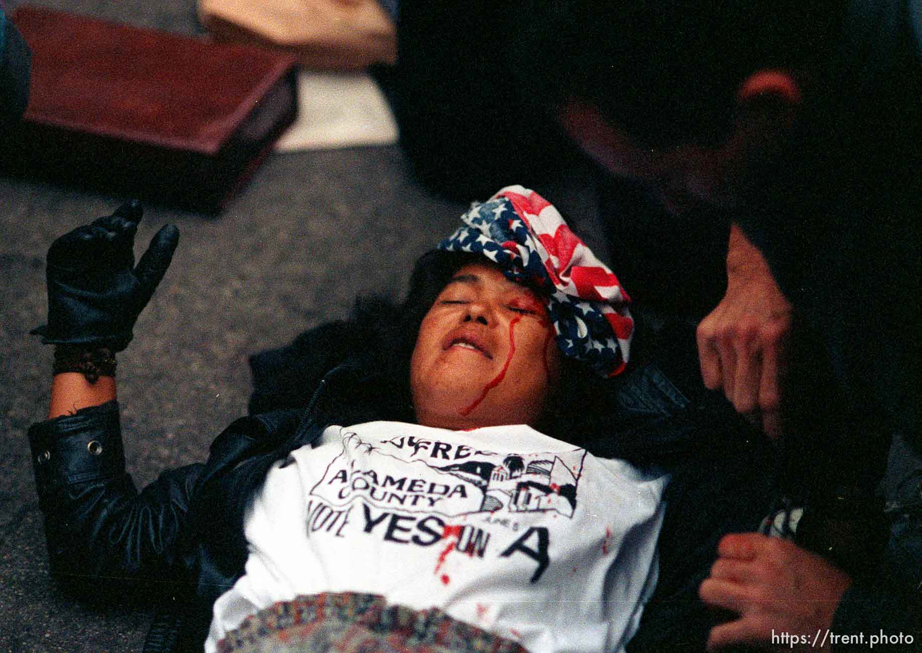 Girl who got hit in head with rock is bandaged with US flag during riots and protests.