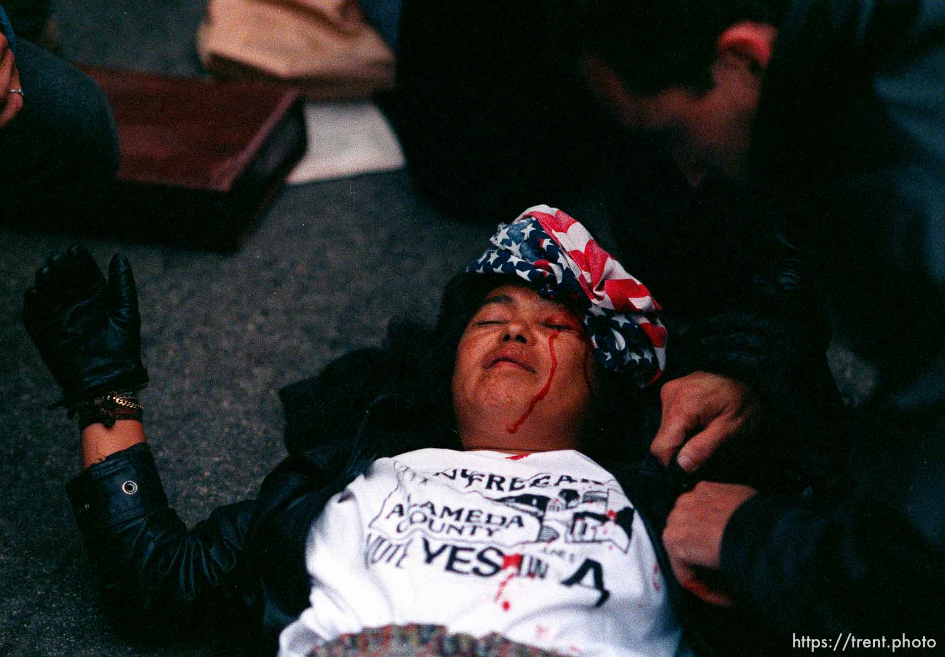 Girl who was hit in head with a rock is bandaged with US flag during riots and protests.