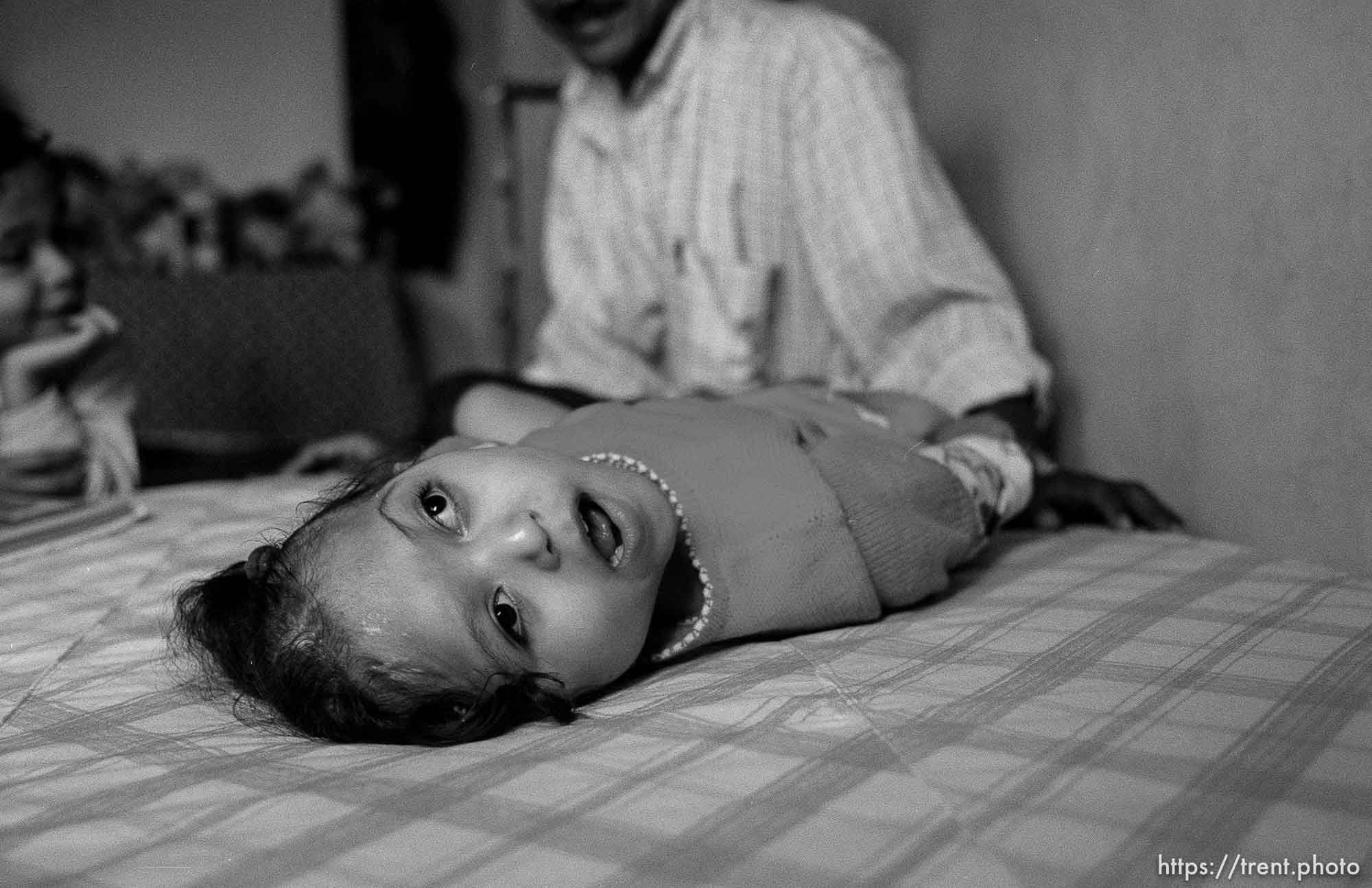 Bessy on bed. Hexi and Jose in background. Formerly conjoined twins, Bessy and Doris Gonzales.