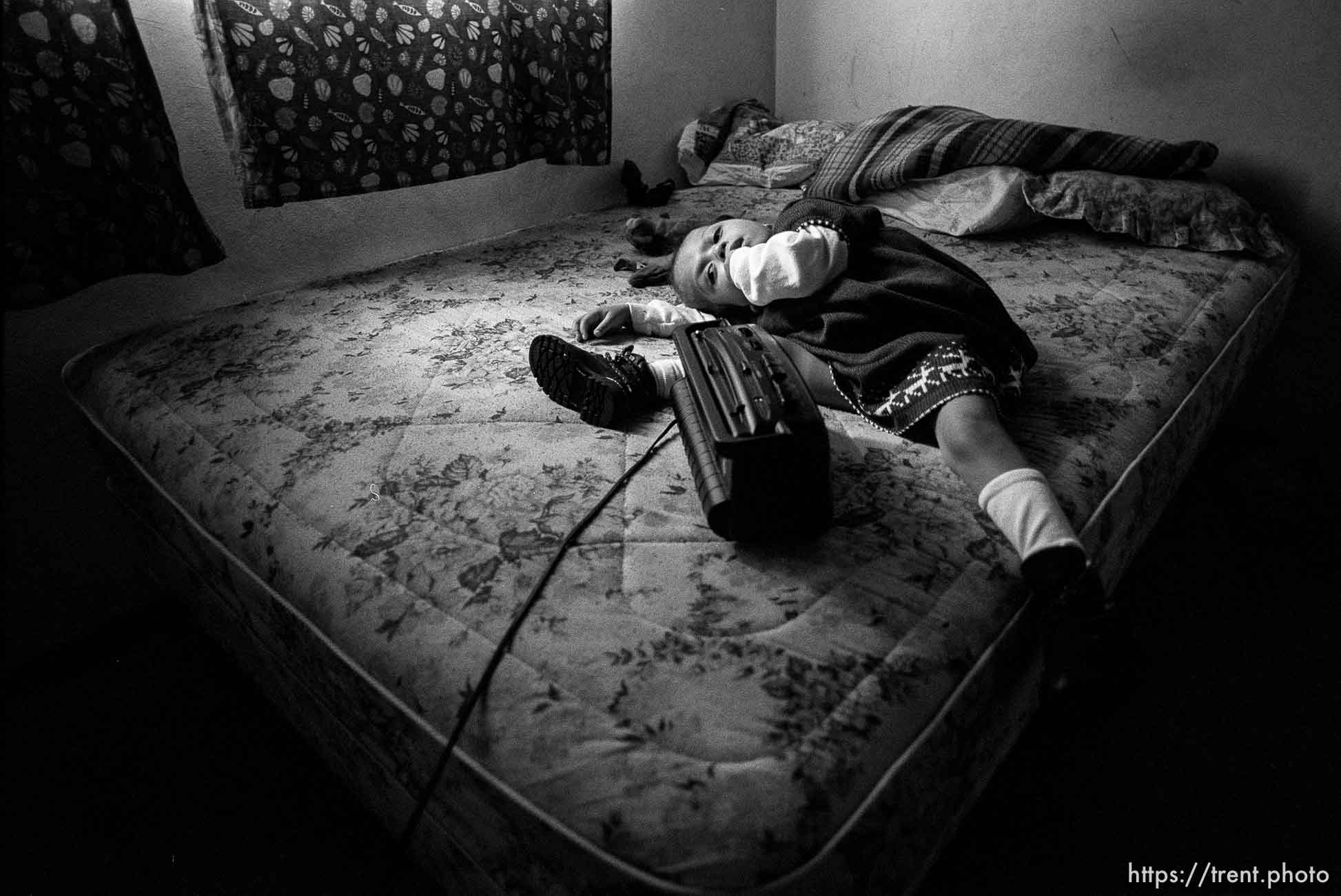 Doris on the bed, listening to the radio. Formerly conjoined twins, Bessy and Doris Gonzales.